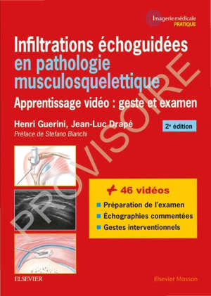 Infiltrations échoguidées en pathologie musculosquelettique : apprentissage vidéo : geste et examen