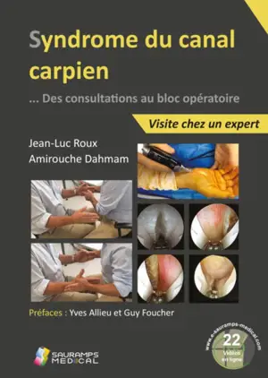 Syndrome du canal carpien : des consultations au bloc opératoire : visite chez un expert