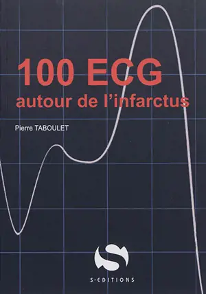 100 ECG autour de l'infarctus