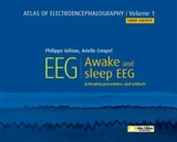 Atlas of electroencephalography. Vol. 1. Awake and sleep EEG : activation procedures and artifacts - Arielle Crespel
