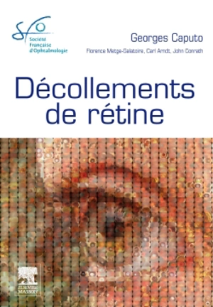 Décollements de rétine : rapport 2011