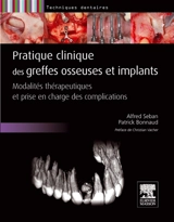 Pratique clinique des greffes osseuses et implants : modalités thérapeutiques et prise en charge des complications - Alfred Seban