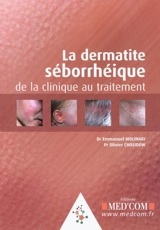 La dermatite séborrhéique : de la clinique au traitement - Emmanuel Molinari