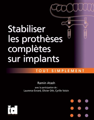 Stabiliser les prothèses complètes sur implants - Ramin Atash