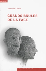 Grands brûlés de la face : épreuves et luttes pour la reconnaissance - Alexandre Dubuis