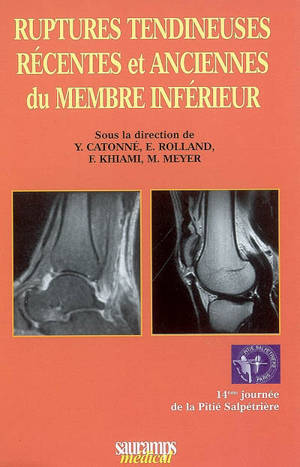 Ruptures tendineuses récentes et anciennes du membre inférieur - Journée de traumatologie de la Pitié-Salpêtrière (14 ; 2008 ; Paris)