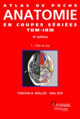 Atlas de poche d'anatomie en coupes sériées TDM-IRM. Vol. 1. Tête et cou - Torsten B. Möller