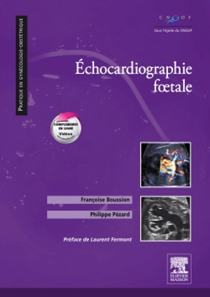Echocardiographie foetale - Philippe Pézard