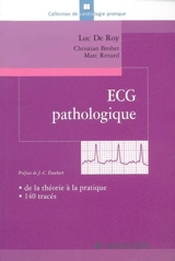 ECG pathologique : de la théorie à la pratique, 140 tracés - Luc De Roy