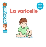 La varicelle - Camille Masson
