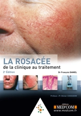 La rosacée : de la clinique au traitement - François Daniel