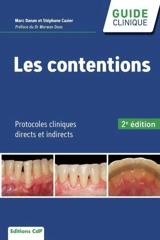 Les contentions : protocoles cliniques directs et indirects - Stéphane Cazier