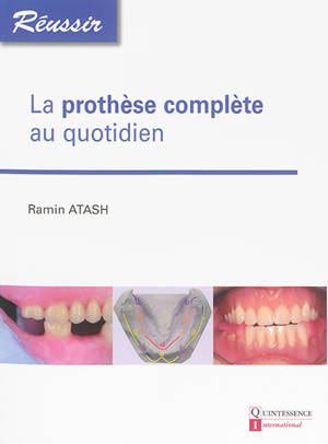 La prothèse complète au quotidien - Ramin Atash