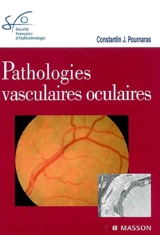 Pathologies vasculaires oculaires : rapport SFO 2008 - Société française d'ophtalmologie