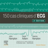 150 cas cliniques d'ECG - John R. Hampton