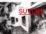 Suture - Clément Kalsa