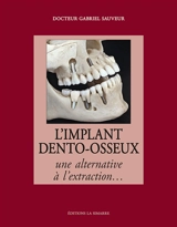 L'implant dento-osseux : une alternative à l'extraction... - Gabriel Sauveur