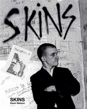 Skins - Watson, Gavin