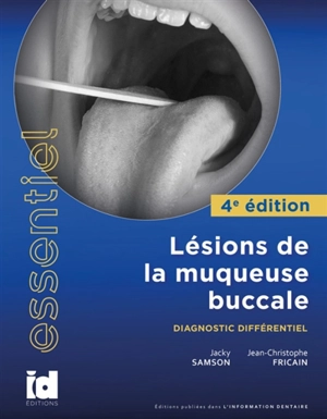Lésions de la muqueuse buccale : diagnostic différentiel - Jacky Samson