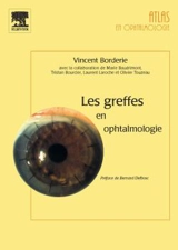 Les greffes en ophtalmologie - Vincent Borderie