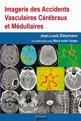 Imagerie des accidents vasculaires cérébraux et médullaires - Jean-Louis Dietemann