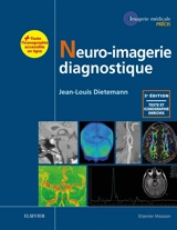 Neuro-imagerie diagnostique - Jean-Louis Dietemann