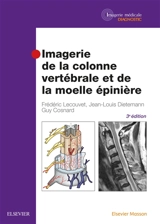 Imagerie de la colonne vertébrale et de la moelle épinière - Frédéric Lecouvet