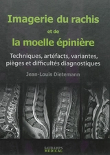 Imagerie du rachis et de la moelle épinière : techniques, artéfacts, variantes, pièges et difficultés diagnostiques - Jean-Louis Dietemann
