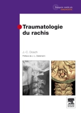 Traumatologie du rachis - Jean-Claude Dosch